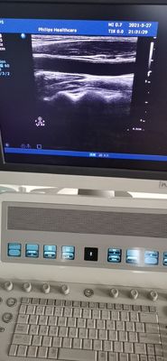 PH L12-5 의료 진단 PH HD9용 초음파 선형 탐사 변수 호환